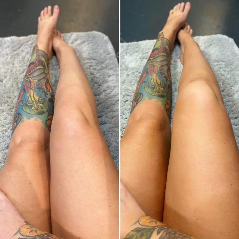 Totally Banging Before and After legs