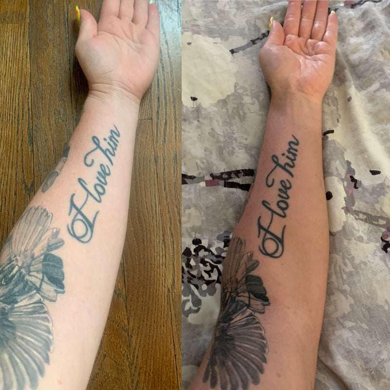 Totally Bangin before and after arm